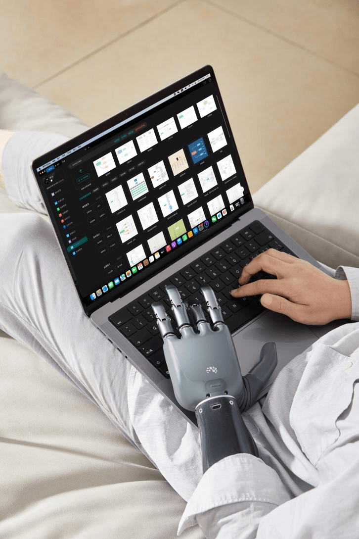 A user wearing a BrainCo intelligent bionic hand comfortably uses a laptop while relaxing on a couch.